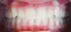 After 2 low res
