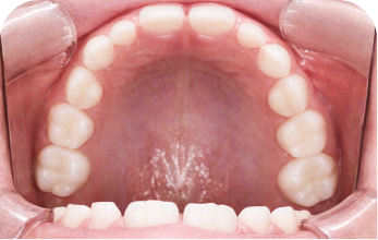 Child's growth appears to be on track