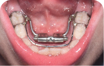 In-person care may better support your child