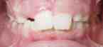 Before 5 low res