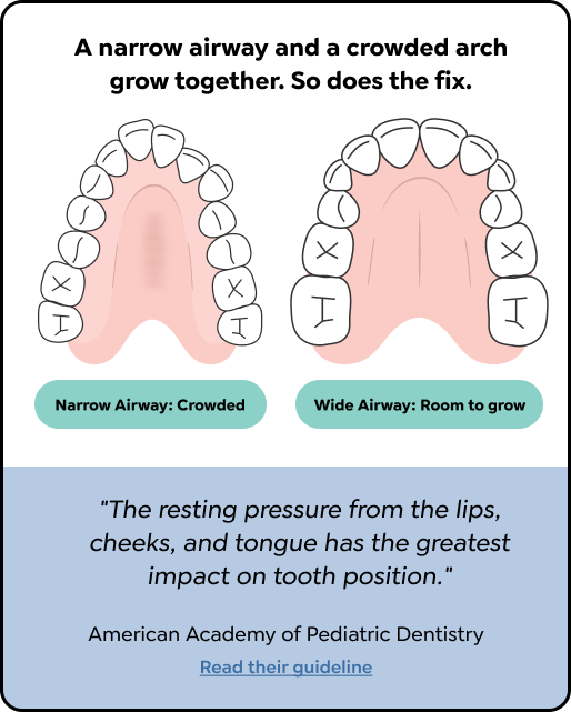 A narrow airway and a crowded arch grow together. A narrow crowded palate beside a wide palate with room to grow. AAPD: the resting pressure from the lips, cheeks, and tongue has the greatest impact on tooth position.