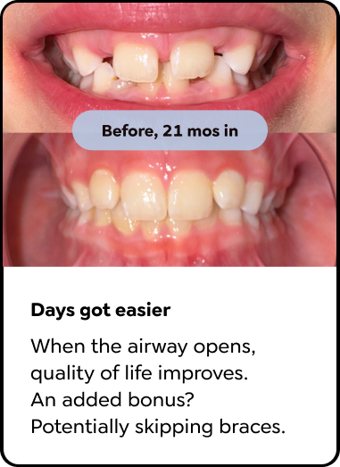 Days got easier. When the airway opens, quality of life improves.